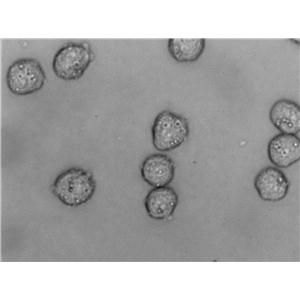 Dami:人巨核细胞白血病复苏细胞(提供STR鉴定图谱)