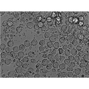 HuT 78:人T淋巴瘤复苏细胞(提供STR鉴定图谱)