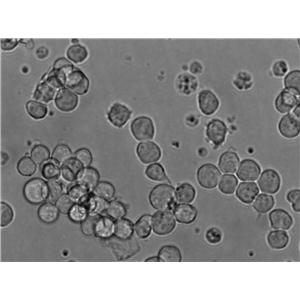 EHEB:人慢性B细胞白血病复苏细胞(提供STR鉴定图谱)