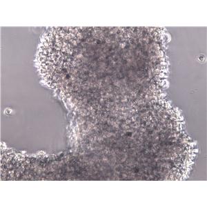NK-92MI:人恶性非霍奇金淋巴瘤患者NK复苏细胞(提供STR鉴定图谱)