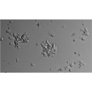 OCI-Ly18:人弥漫大B细胞淋巴瘤复苏细胞(提供STR鉴定图谱)