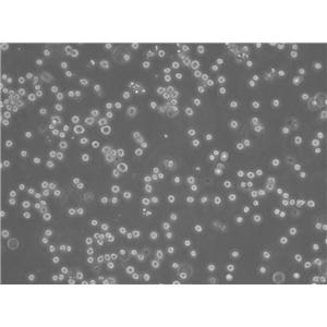 MN-60:人B细胞白血病复苏细胞(提供STR鉴定图谱)