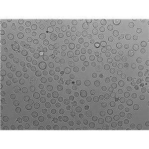 RPMI-8402:人急性T淋巴细胞白血病复苏细胞(提供STR鉴定图谱)