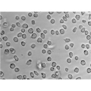 EoL-1:人急性髓系白血病复苏细胞(提供STR鉴定图谱)