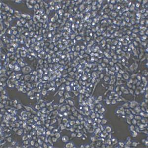 HOP-92 Cell|人小细胞肺癌细胞
