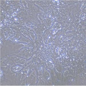 ECC10 Cell|人子宫内膜癌细胞