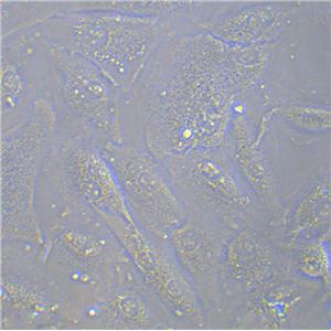 ECC12 Cell|人子宫内膜癌细胞,ECC12 Cell