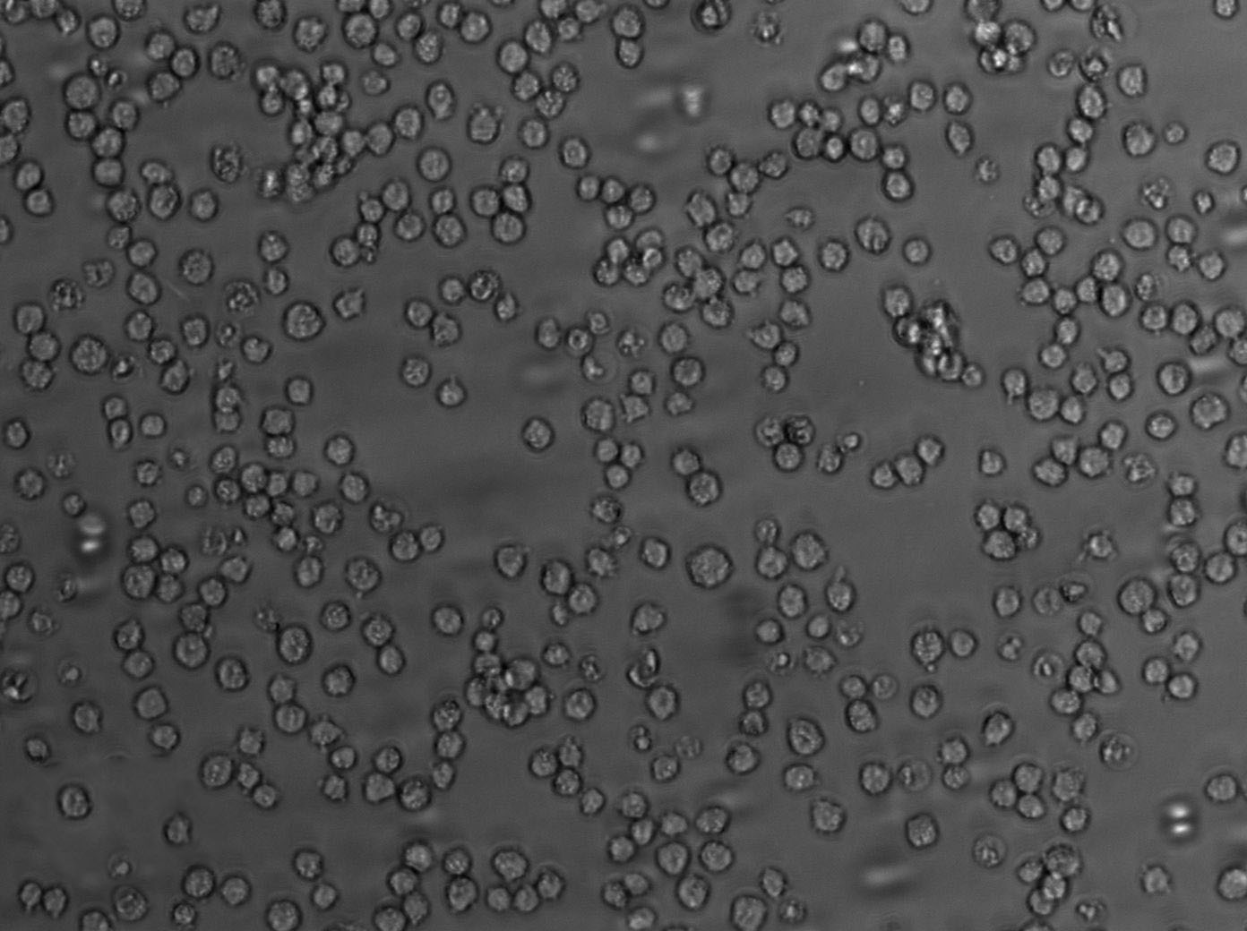 Farage Cell Lines:人B淋巴瘤細(xì)胞(STR認(rèn)證),Farage Cell Lines