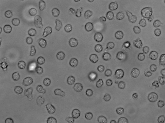 Raji Cell Lines:人Burkitt’s淋巴瘤细胞(STR认证),Raji Cell Lines