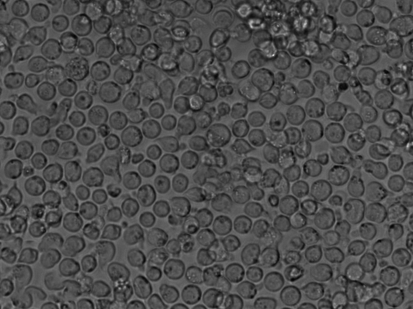 MOLT-4 Cell Lines:人急性淋巴母細(xì)胞性白血病細(xì)胞(STR認(rèn)證),MOLT-4 Cell Lines