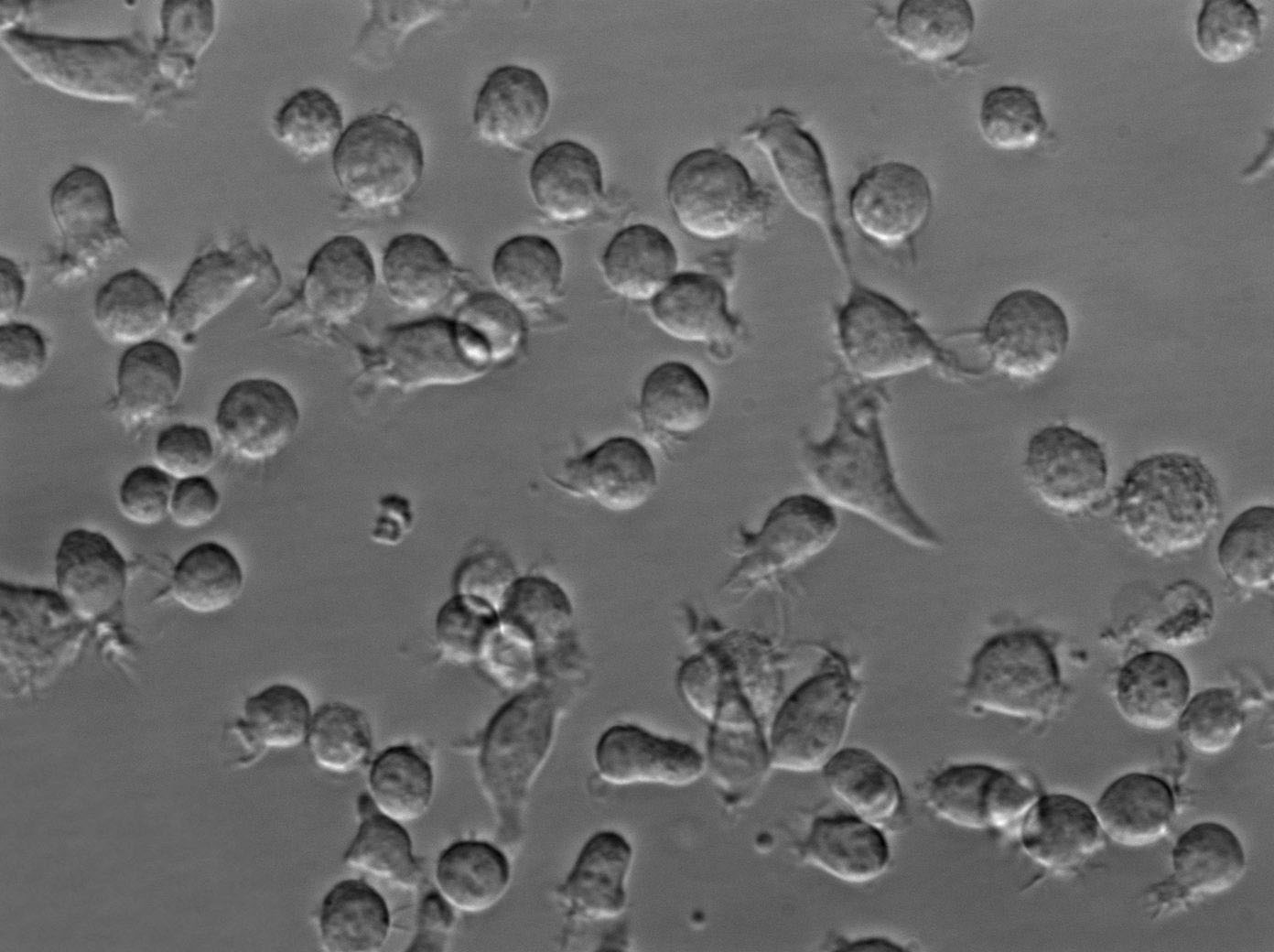 JVM-2 Cell Lines:EB病毒感染的人外周淋巴细胞(STR认证),JVM-2 Cell Lines