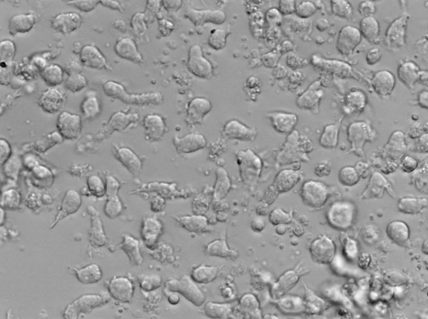 AML-193 Cell Lines:人急性单核细胞白血病单核细胞(STR认证),AML-193 Cell Lines