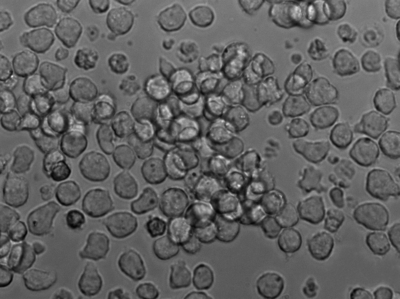 Mino Cell Lines:人淋巴细胞瘤细胞(STR认证),Mino Cell Lines