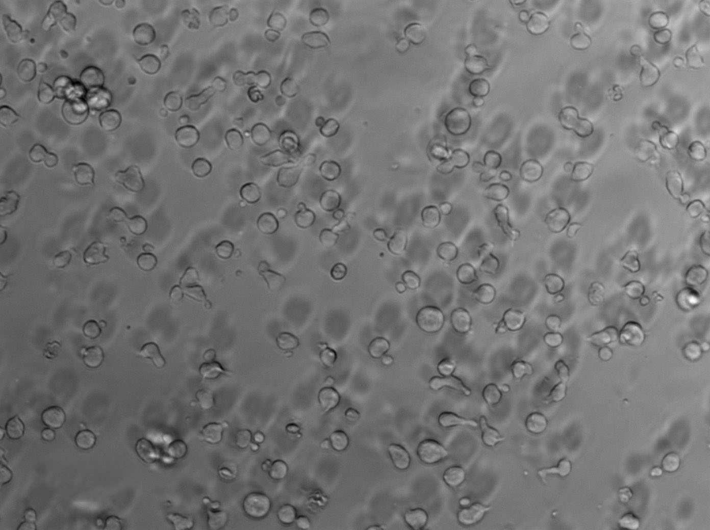 Namalwa Cell Lines:人Burkitt＇s淋巴瘤细胞(STR认证),Namalwa Cell Lines
