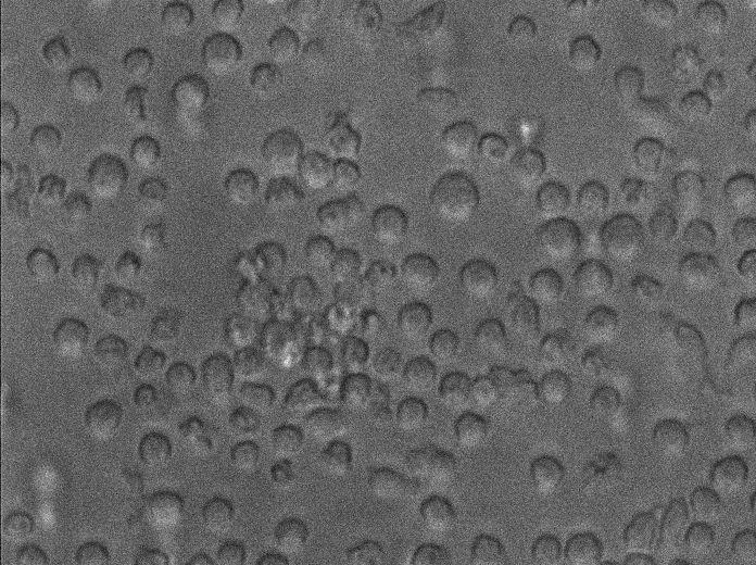 HL-60 Clone 15 Cell Lines:人急性早幼粒细胞白血病细胞(STR认证),HL-60 Clone 15 Cell Lines