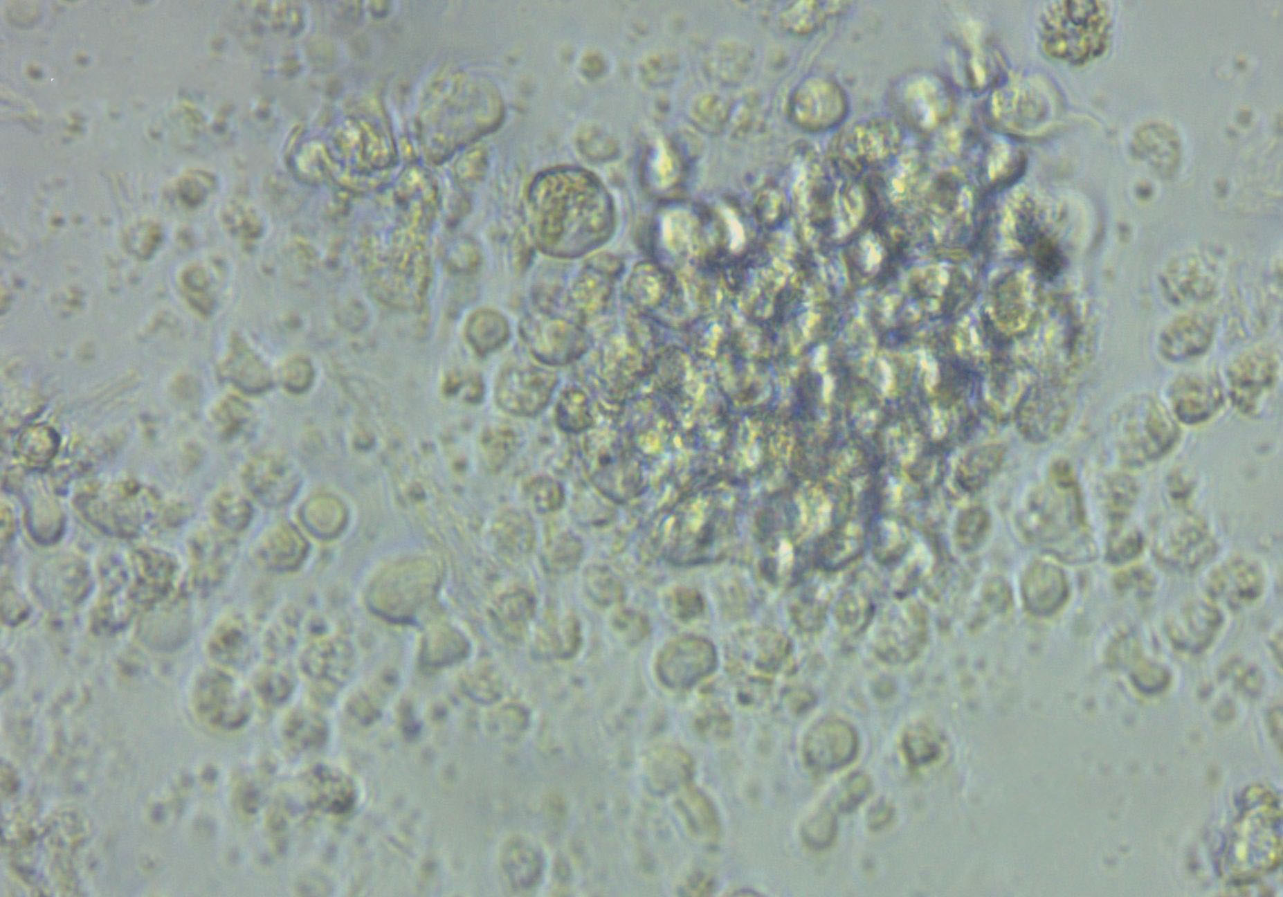 Jurkat Cell Lines:人急性T淋巴细胞白血病细胞(STR认证),Jurkat Cell Lines