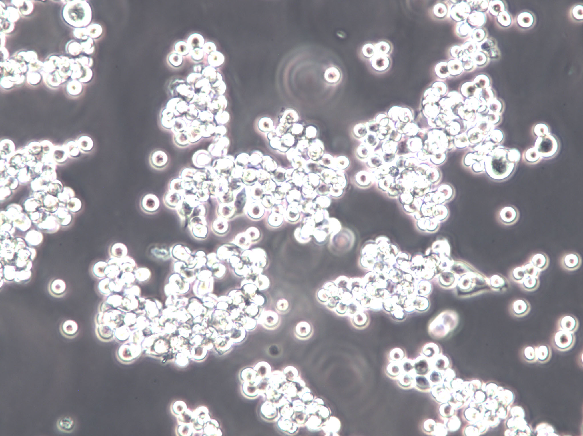 EHEB Cell Lines:人慢性B细胞白血病细胞(STR认证),EHEB Cell Lines