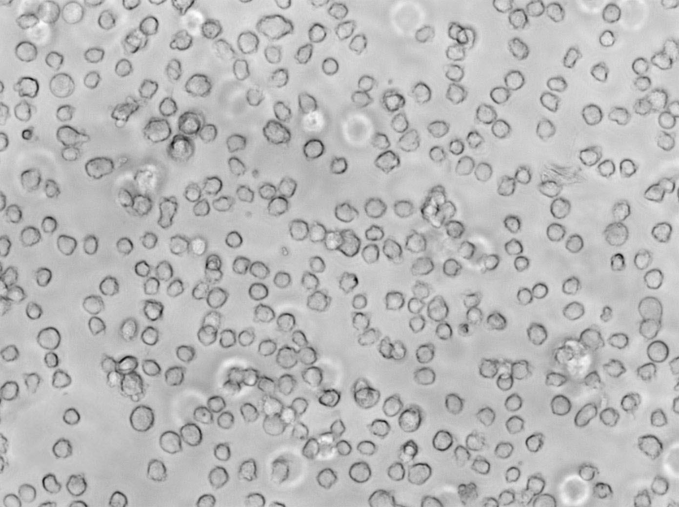 KBM-5 Cell Lines:人慢性髓白血病细胞(STR认证),KBM-5 Cell Lines