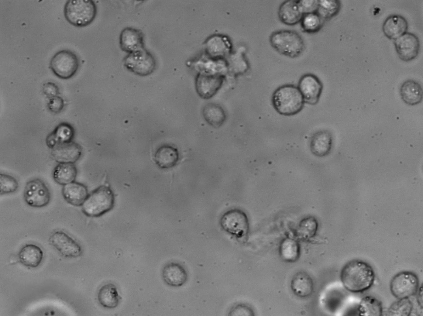 NK-92 Cell Lines:人恶性非霍奇金淋巴瘤患者NK细胞(STR认证),NK-92 Cell Lines