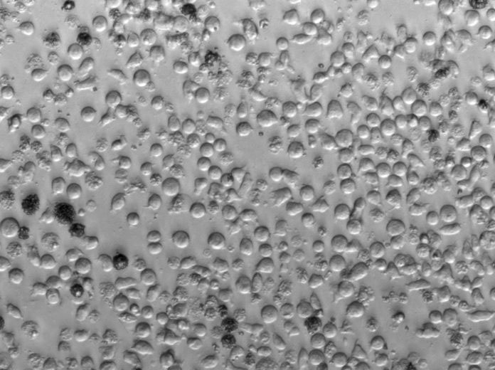 SU-DHL-1 Cell Lines:人间变性大细胞淋巴瘤细胞(STR认证),SU-DHL-1 Cell Lines