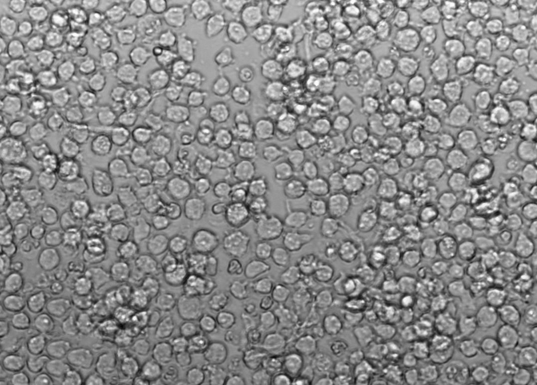 KOPN-8 Cell Lines:人B淋巴细胞白血病细胞(STR认证),KOPN-8 Cell Lines