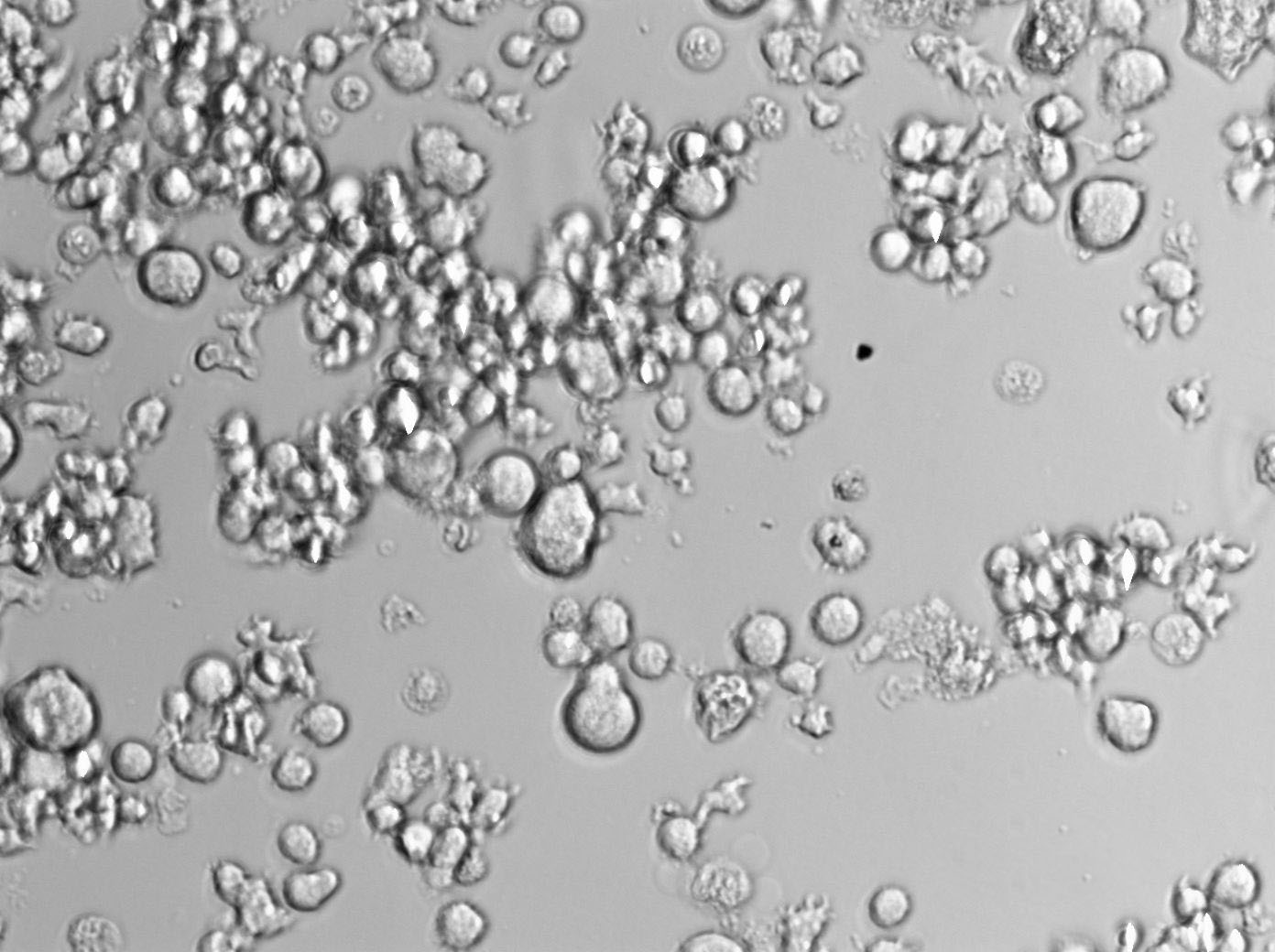 OCI-Ly1 Cell Lines:人弥漫大B淋巴瘤细胞(STR认证),OCI-Ly1 Cell Lines