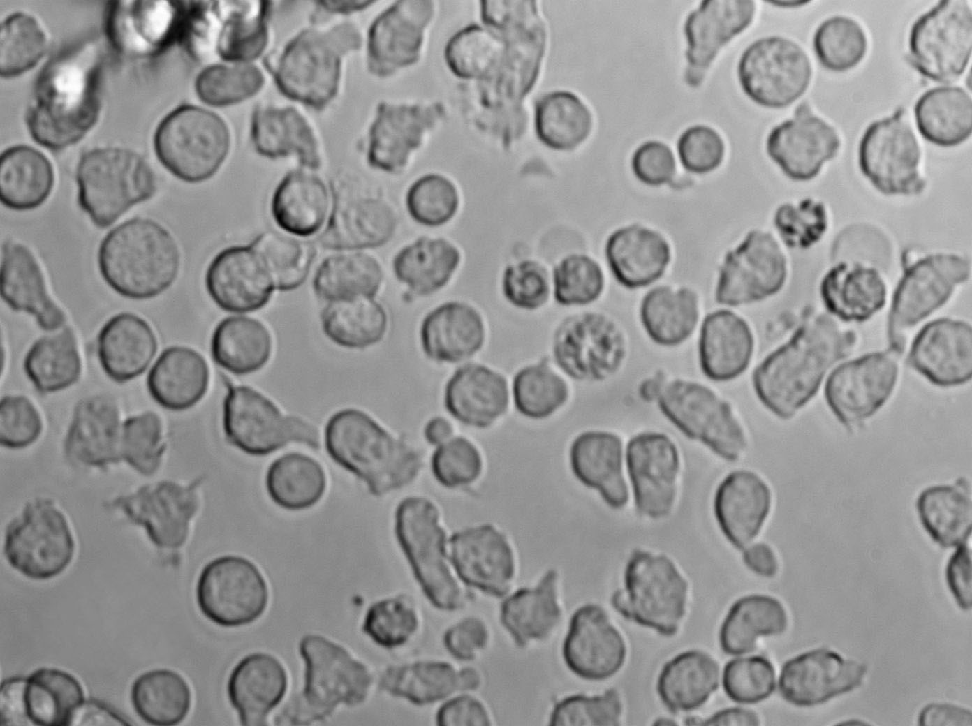 OCI-Ly19 Cell Lines:人彌漫大B淋巴瘤細胞(STR認證),OCI-Ly19 Cell Lines