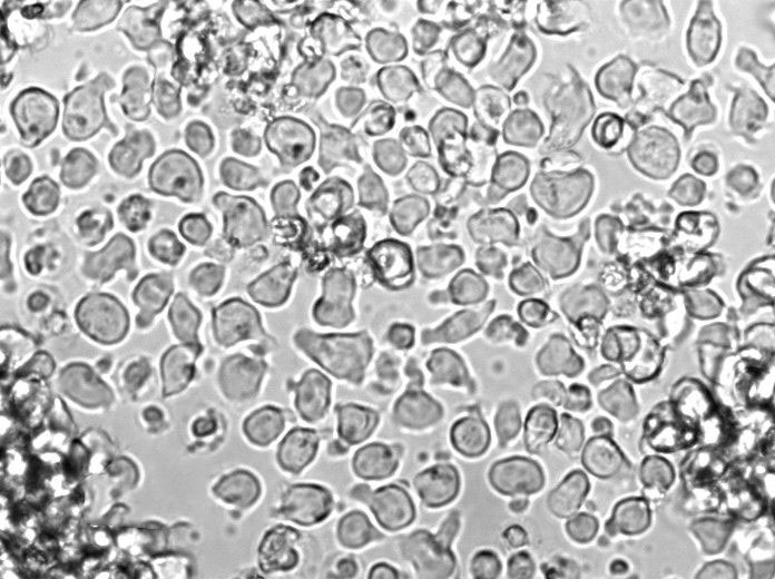 HDLM-2 Cell Lines:人霍奇金淋巴瘤细胞(STR认证),HDLM-2 Cell Lines