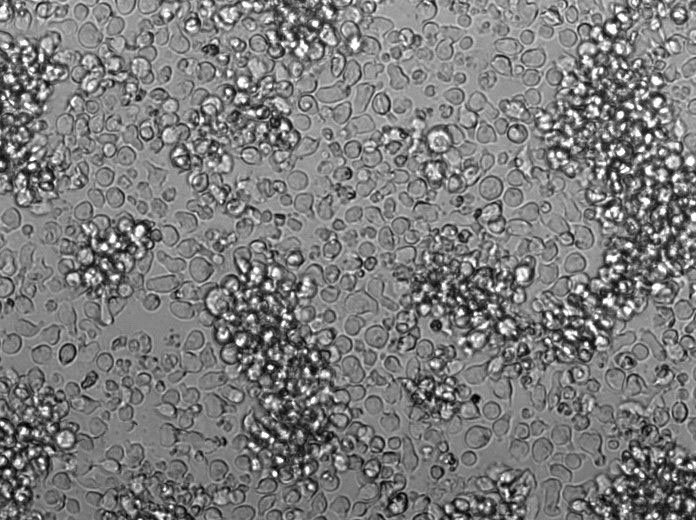 L-428 Cell Lines:人霍奇金淋巴瘤细胞(STR认证),L-428 Cell Lines