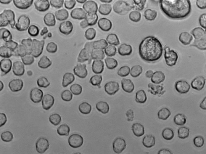 KM-H2 Cell Lines:人霍奇金淋巴瘤细胞(STR认证),KM-H2 Cell Lines