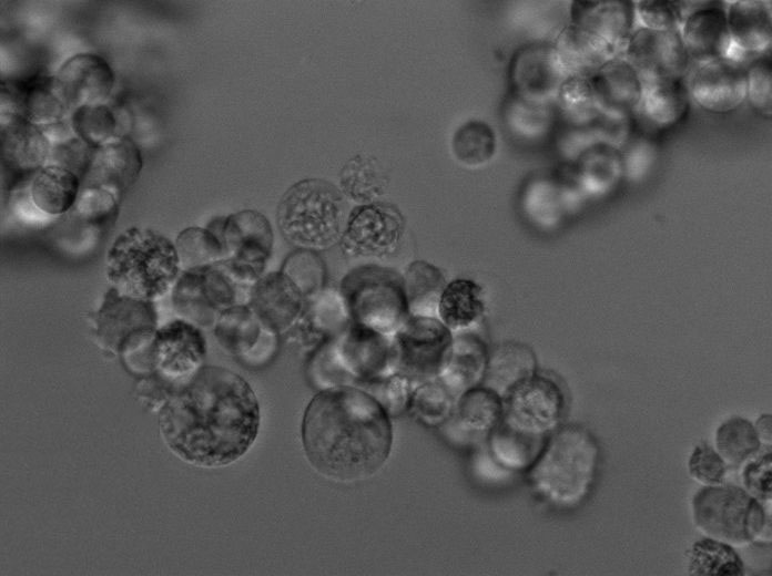 TK-1 Cell Lines:小鼠T淋巴瘤细胞(STR认证),TK-1 Cell Lines