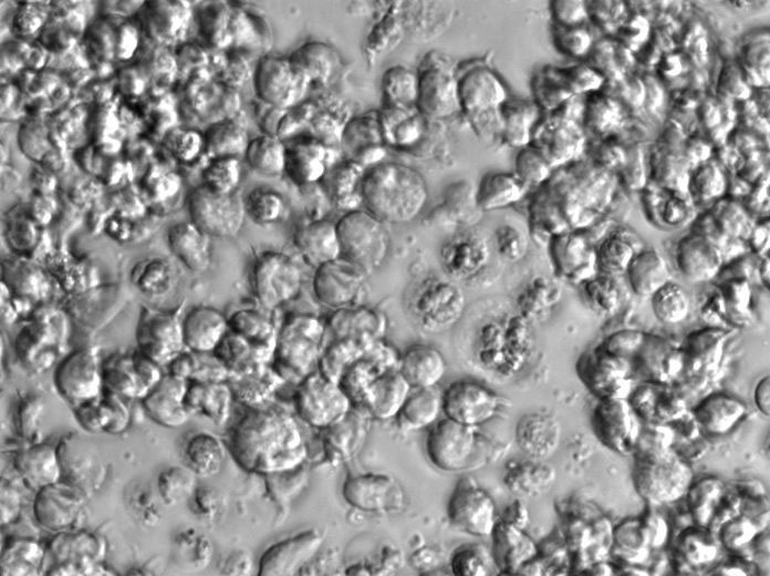 OCI-Ly7 Cell Lines:人彌漫大B淋巴瘤細(xì)胞(STR認(rèn)證),OCI-Ly7 Cell Lines