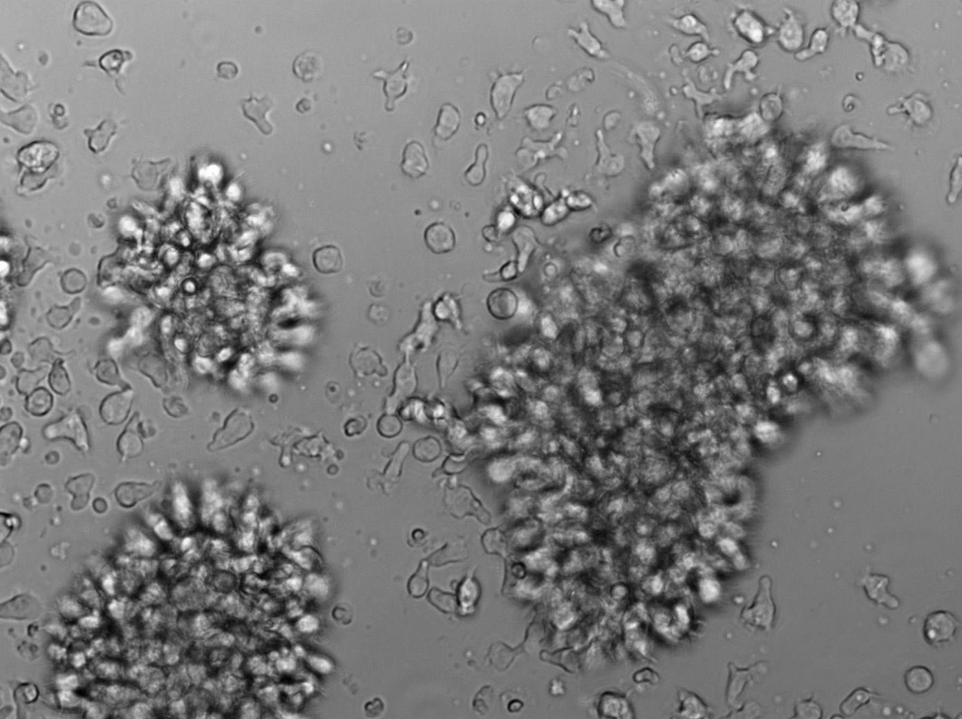 MOLM-16 Cell Lines:人急性髓系白血病细胞(STR认证),MOLM-16 Cell Lines