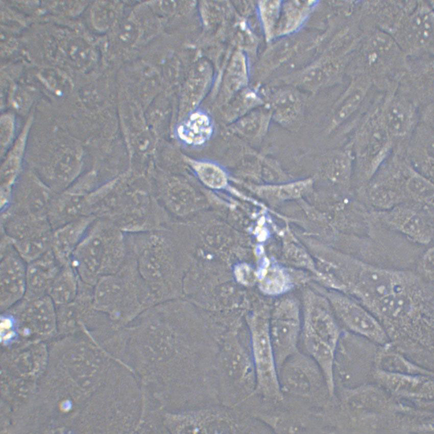 QBC939 Cell|人胆管癌细胞,QBC939 Cell