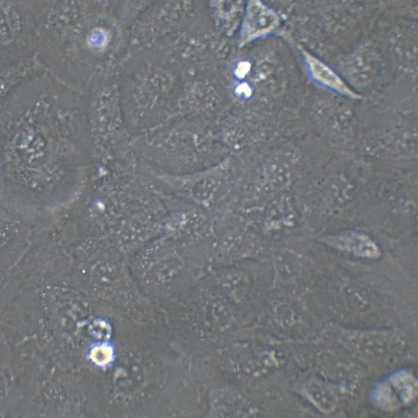 Ketr-3 Cell|人腎癌細胞,Ketr-3 Cell