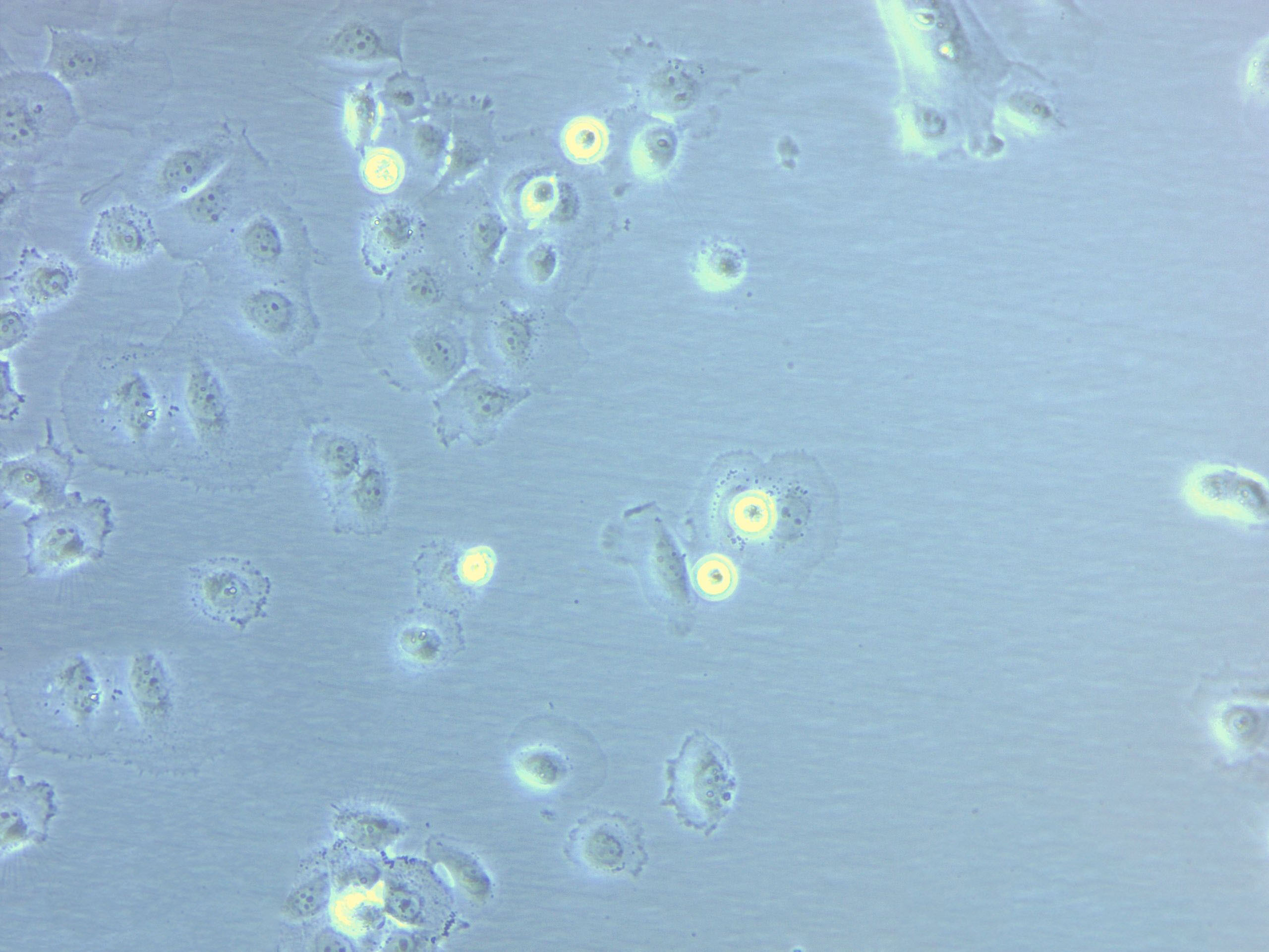 Eca-109 Cell|人食管癌细胞,Eca-109 Cell