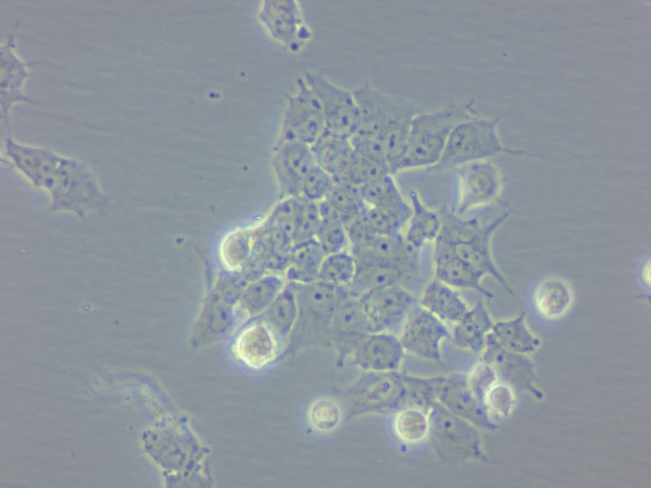 H22 Cell|小鼠肝癌细胞,H22 Cell