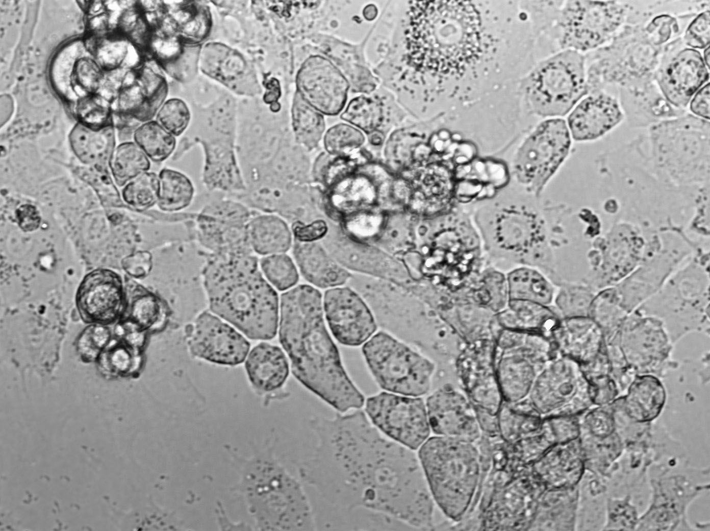 SW1353 Cell|人軟骨肉瘤細(xì)胞,SW1353 Cell