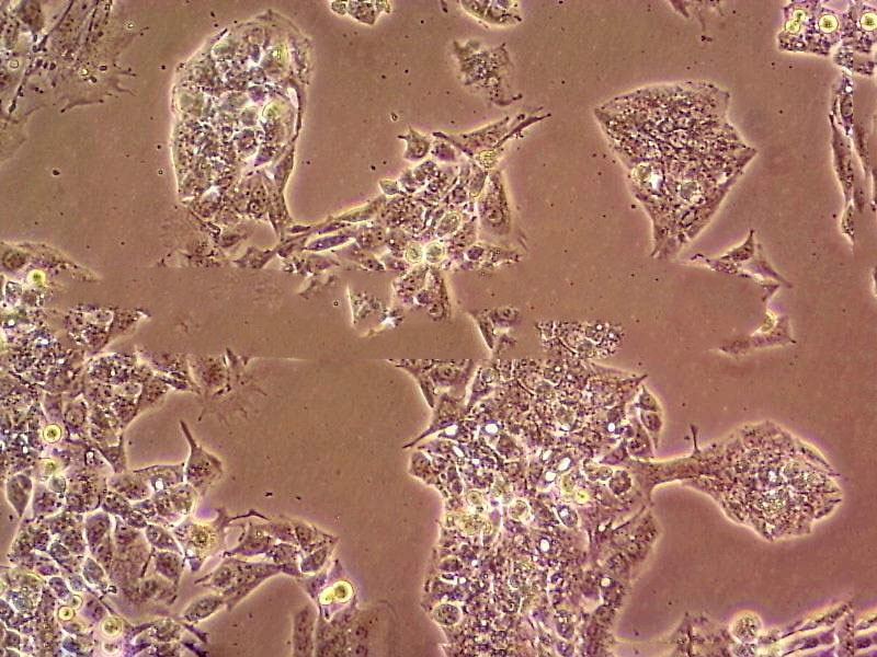 P815 Cell|小鼠肥大细胞瘤细胞,P815 Cell