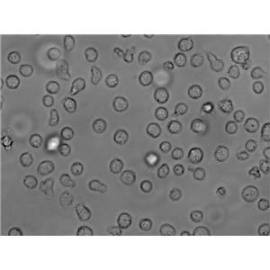 Raji Cell Lines:人Burkitt’s淋巴瘤细胞(STR认证)