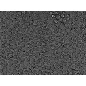 MOLT-4 Cell Lines:人急性淋巴母細(xì)胞性白血病細(xì)胞(STR認(rèn)證),MOLT-4 Cell Lines