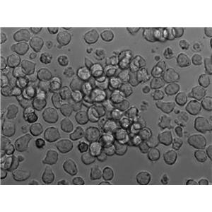 Mino Cell Lines:人淋巴细胞瘤细胞(STR认证)