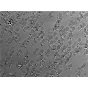 Namalwa Cell Lines:人Burkitt＇s淋巴瘤细胞(STR认证)