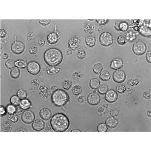 SU-DHL-6 Cell Lines:人淋巴瘤细胞(STR认证)