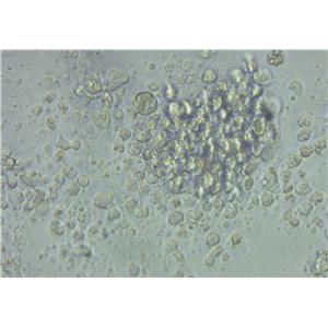 Jurkat Cell Lines:人急性T淋巴细胞白血病细胞(STR认证)