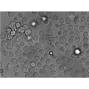 MUTZ-3 Cell Lines:急性非淋巴白血病细胞(STR认证)