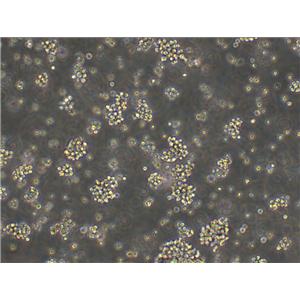 NALM-6 Cell Lines:人急性B淋巴白血病细胞(STR认证)