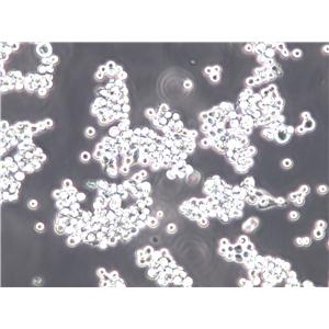 EHEB Cell Lines:人慢性B细胞白血病细胞(STR认证),EHEB Cell Lines