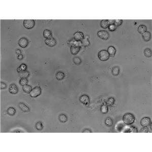 NK-92 Cell Lines:人恶性非霍奇金淋巴瘤患者NK细胞(STR认证),NK-92 Cell Lines