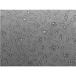 SU-DHL-2 Cell Lines:人弥漫性大细胞淋巴瘤细胞(STR认证)